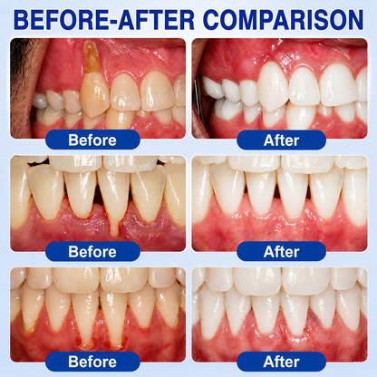 🦷 HISKIN® GumRevive Periodontal Repair Gel