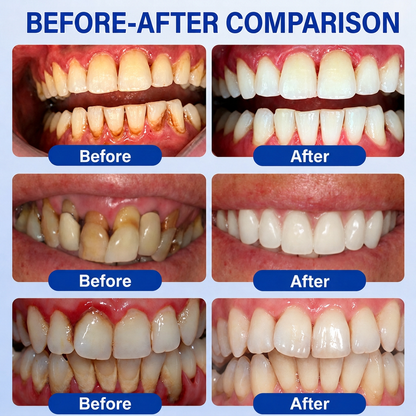 🦷 HISKIN® GumRevive Periodontal Repair Gel