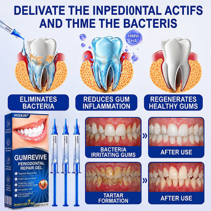 🦷 HISKIN® GumRevive Periodontal Repair Gel